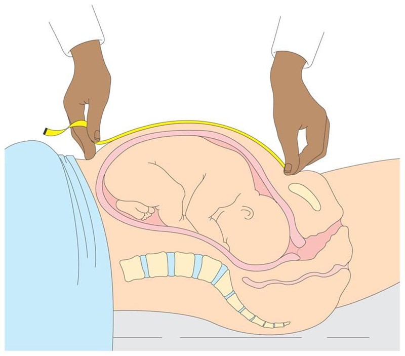 Sorry for the rather graphic nature of this diagram