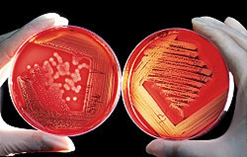 Agar Lady